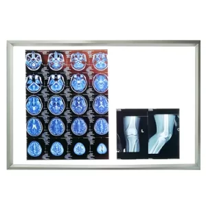 Stainless Steel Operating Room X Ray View Box with Built-in LED Panel